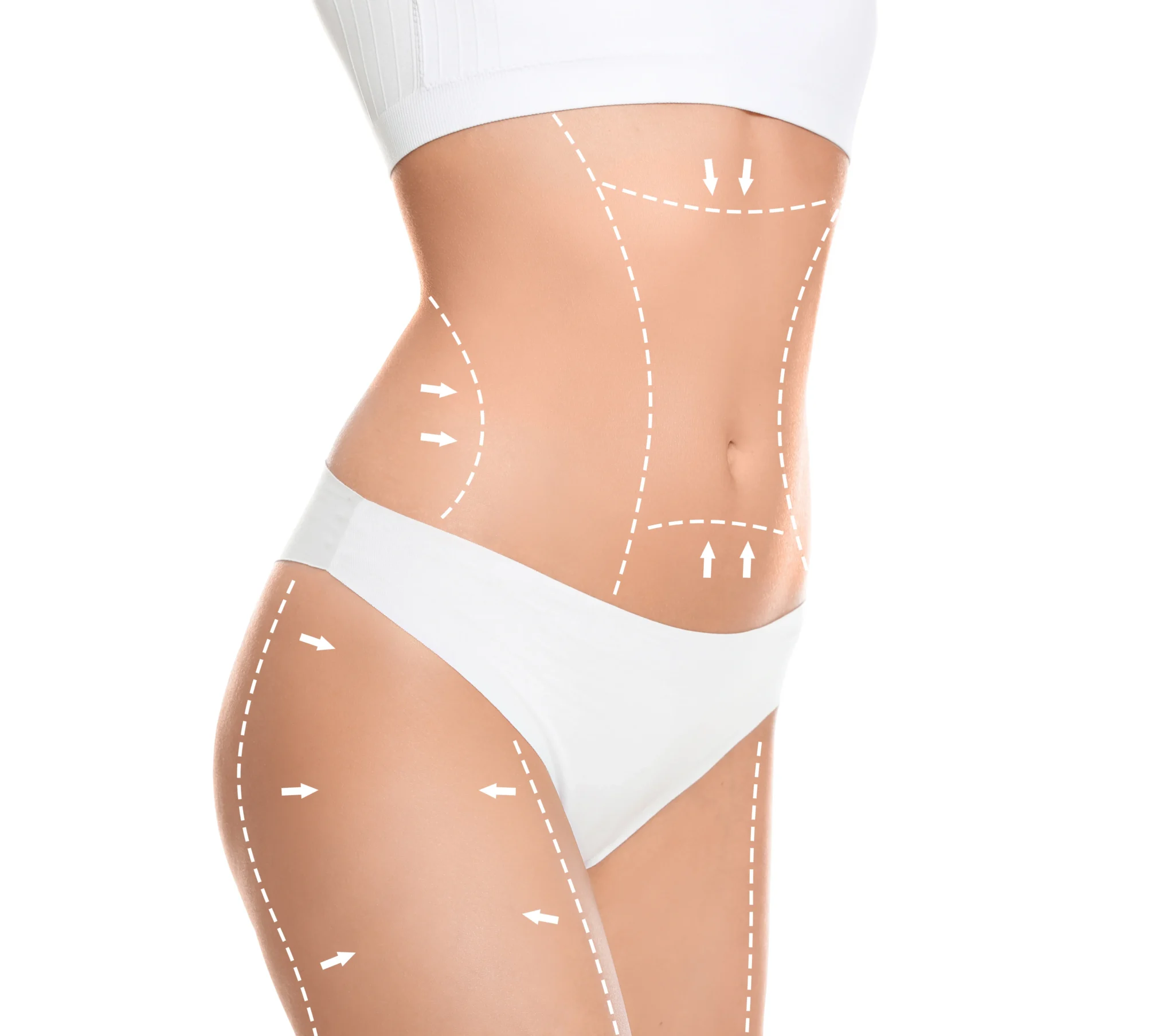 slim-young-woman-with-marks-body-cosmetic-surgery-operation-against-white-background-closeup