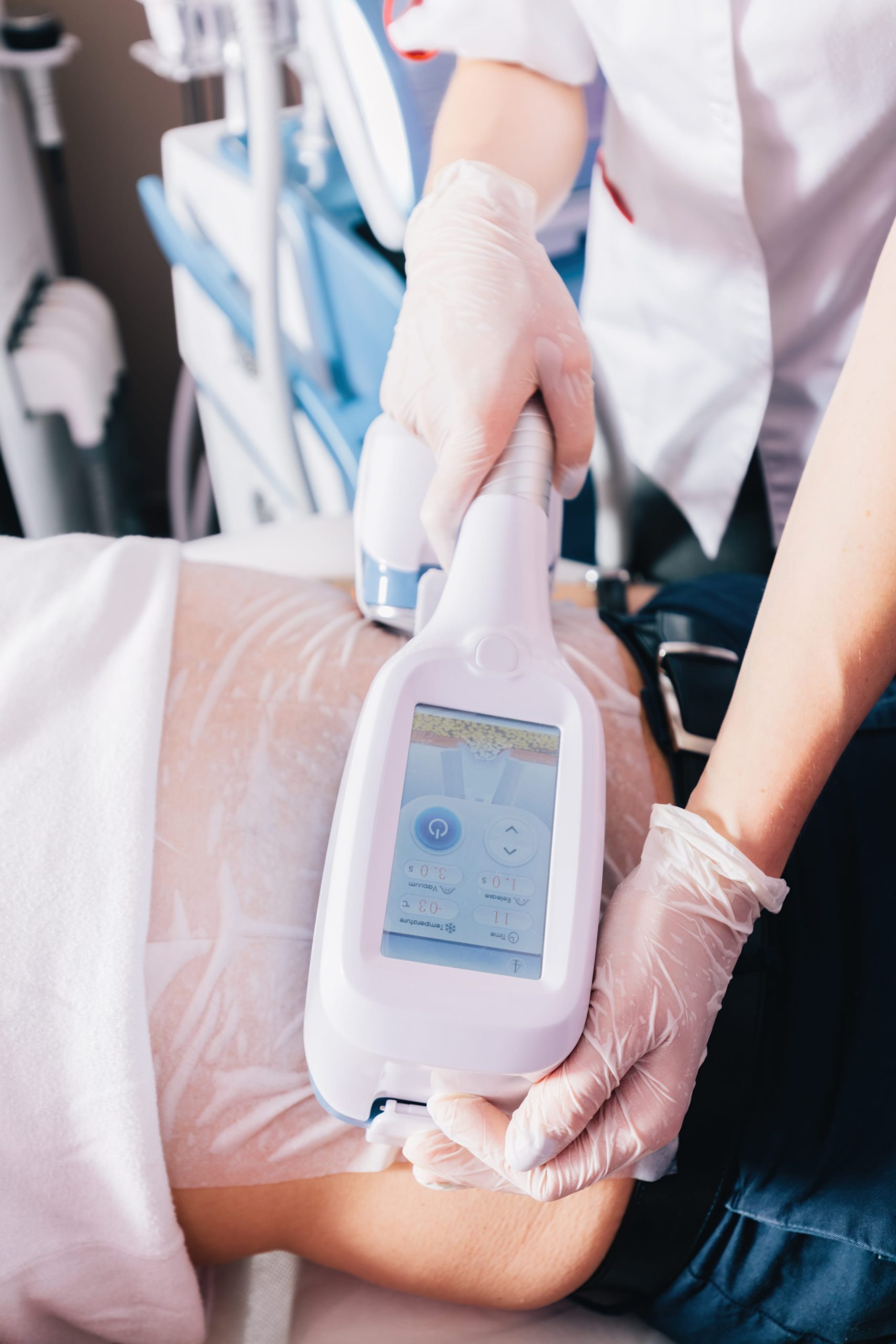 Fat Freezing Treatment