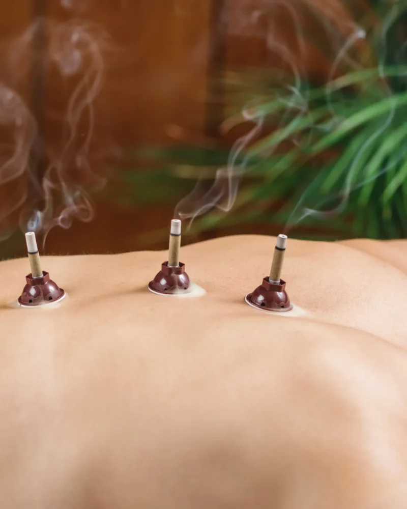moxibustion-traditional-chinese-medicine-technique