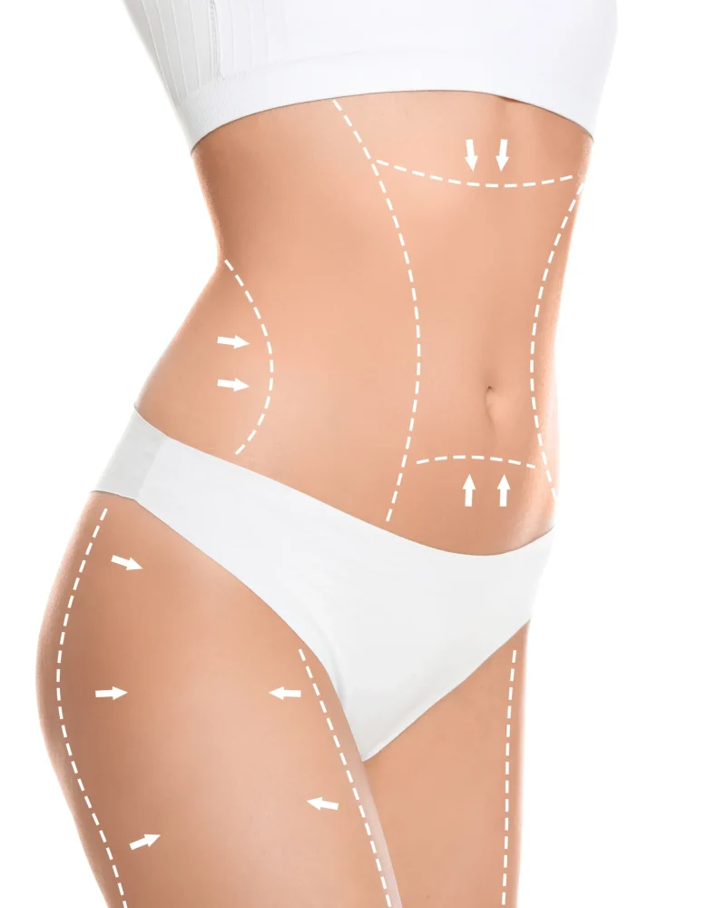 slim-young-woman-with-marks-body-cosmetic-surgery-operation-against-white-background-closeup